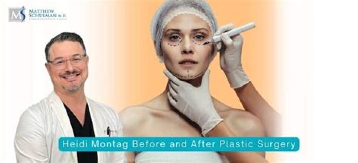 Heidi Montag Transformation Before Surgery: An Incredible Journey