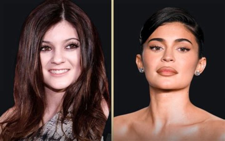 The Weighty Journey Of Kylie Jenner: From Rumors To Facts