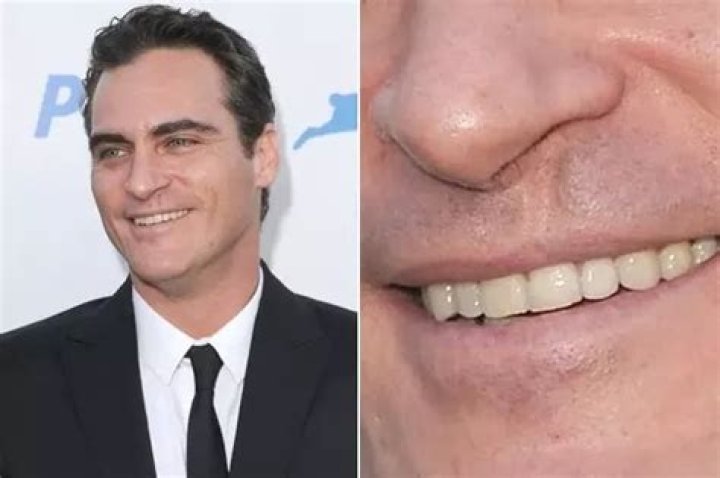 Unveiling The Mystery Behind Joaquin Phoenix's Scar Lip