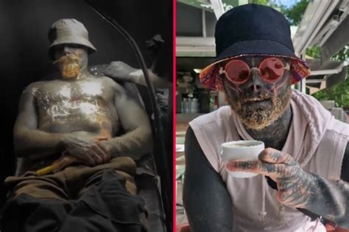 Who Is Anthony Loffredo Wife? Before And After Photos Of The Most Modified Man Who Chopped Off Two Fingers